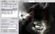 Screenshot of the IP Appliance technology in use at A Smiling Heart Dentistry in Bellevue, WA Screenshot of the IP Appliance technology in use at A Smiling Heart Dentistry in Bellevue, WA